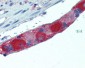 AMPH / Amphiphysin Antibody (clone 3)